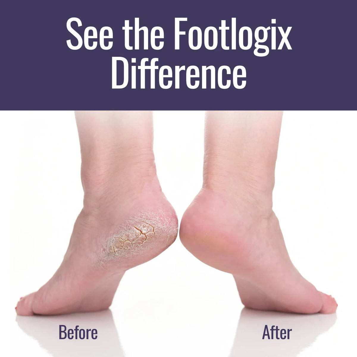 Ultimate At-Home Foot Care Combo – Callus Softener & Foot File
